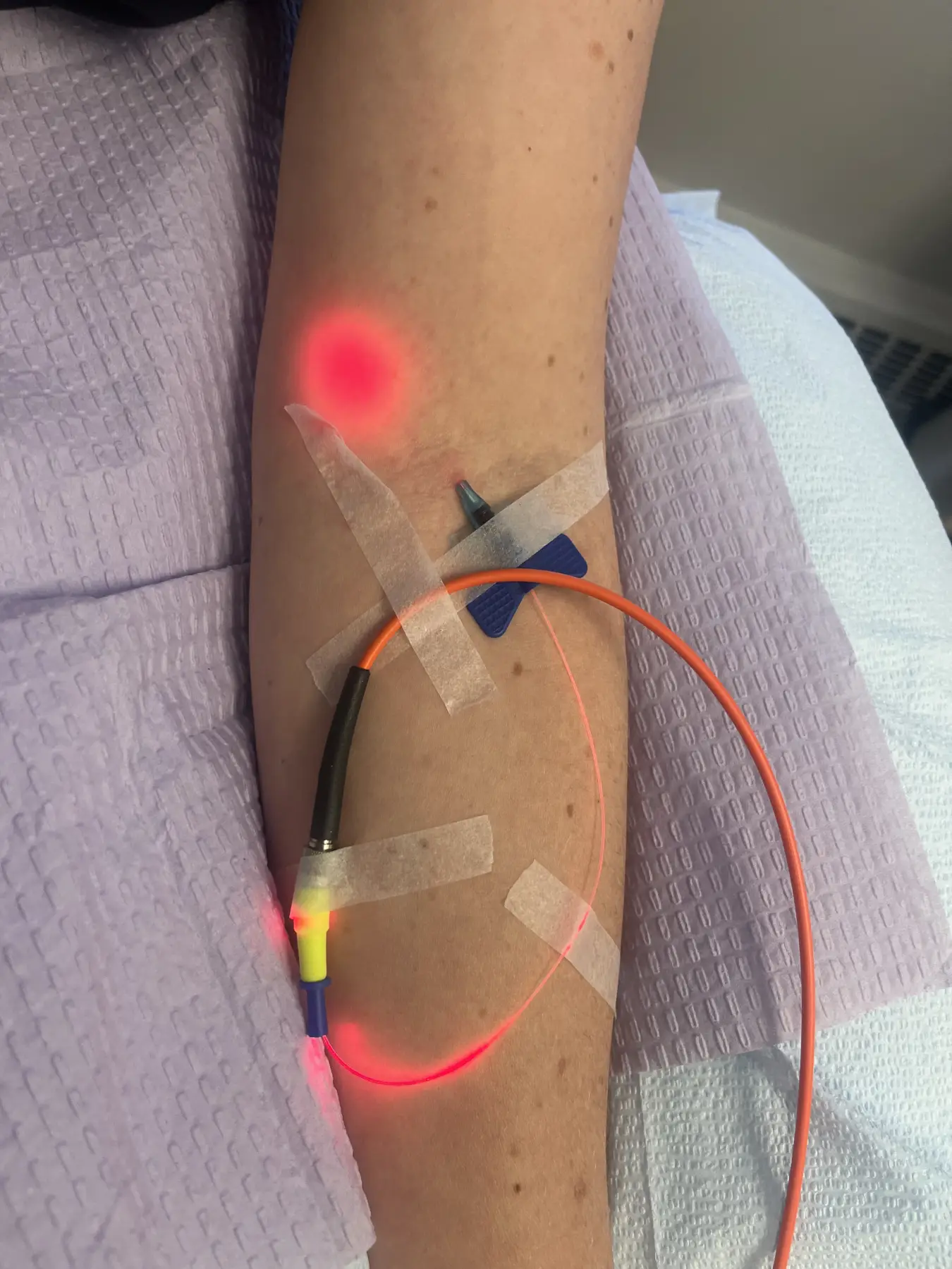 Laser light therapy being delivered at Bionuu Clinic in the Denver area